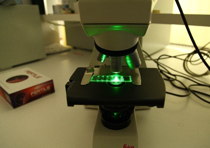 Bu Çipler, Sağlıklı Spermi 12’den Vuruyor