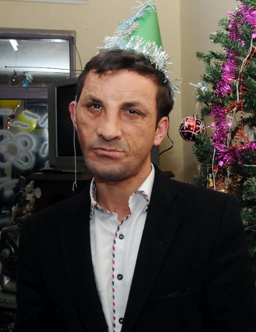 Uğur Acar, Yüz Naklinin 4. Yılında Grip Nedeniyle Hastanede Tedavi Görüyor