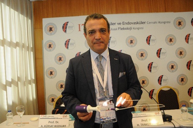 Varise, Zamk Yapıştırıcı Yöntemi İle Kesin Çözüm