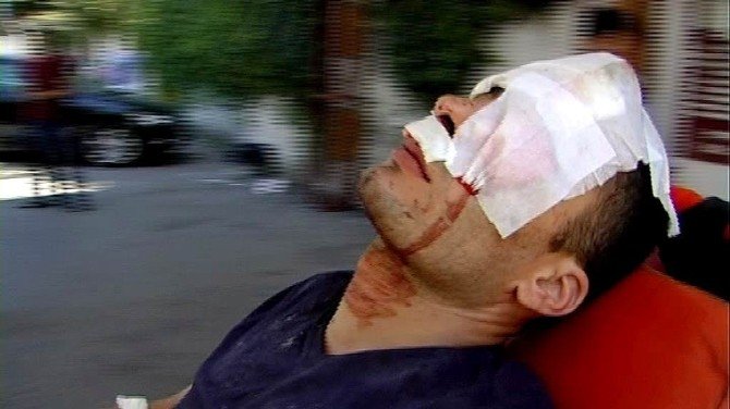 Uludağ’ın Eteğinde Dinamit Bomba Gibi Patladı: 2 Defineci Öldü, Birisi Yaralı 4 Kişi Kurtuldu